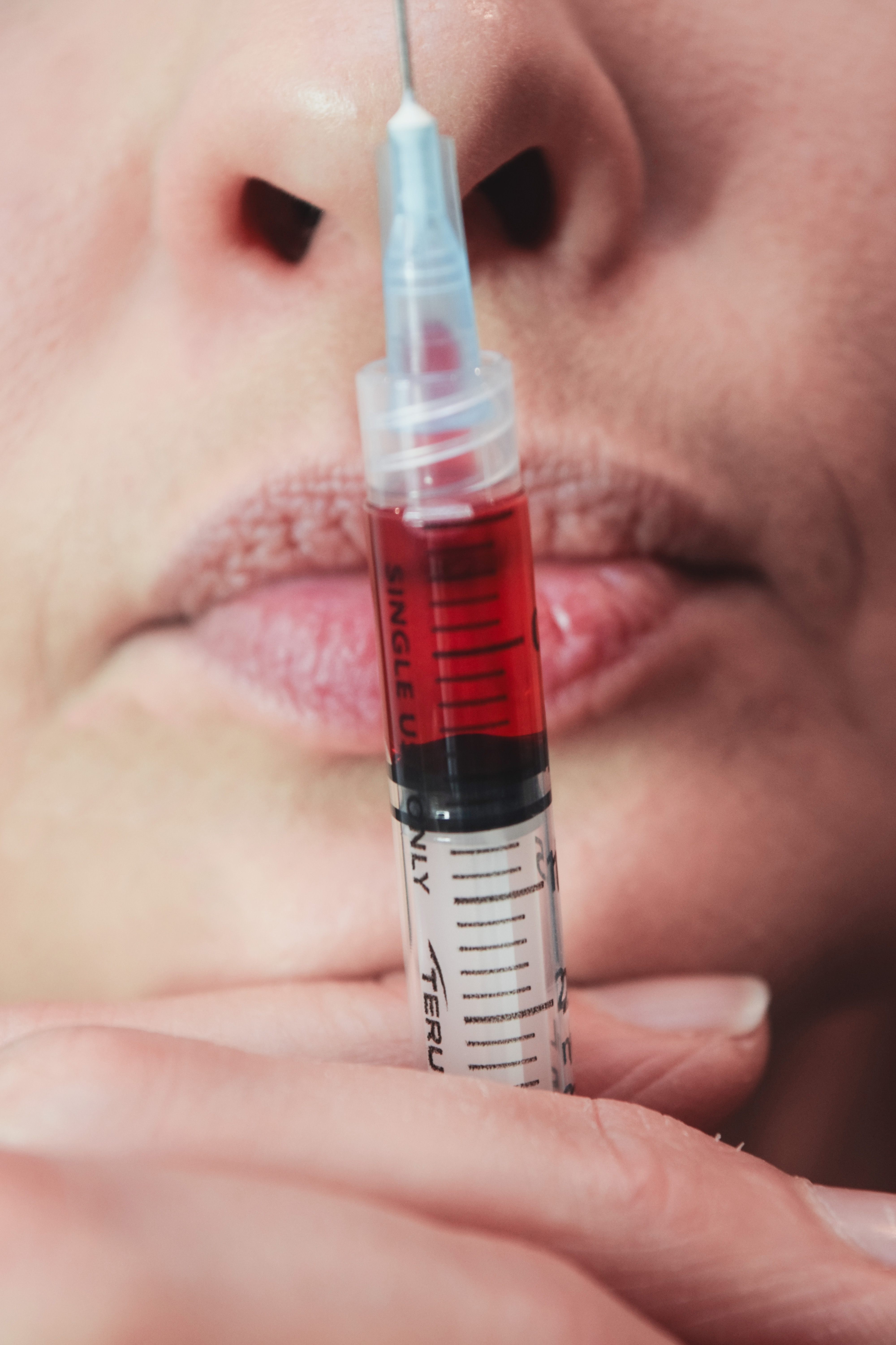 Facial injectable treatment preparation