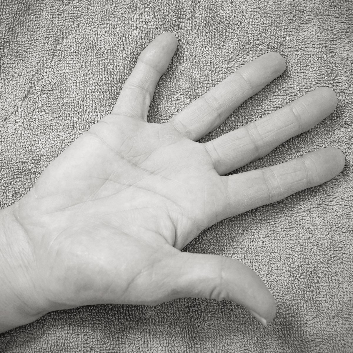 Hand treatment image detail view
