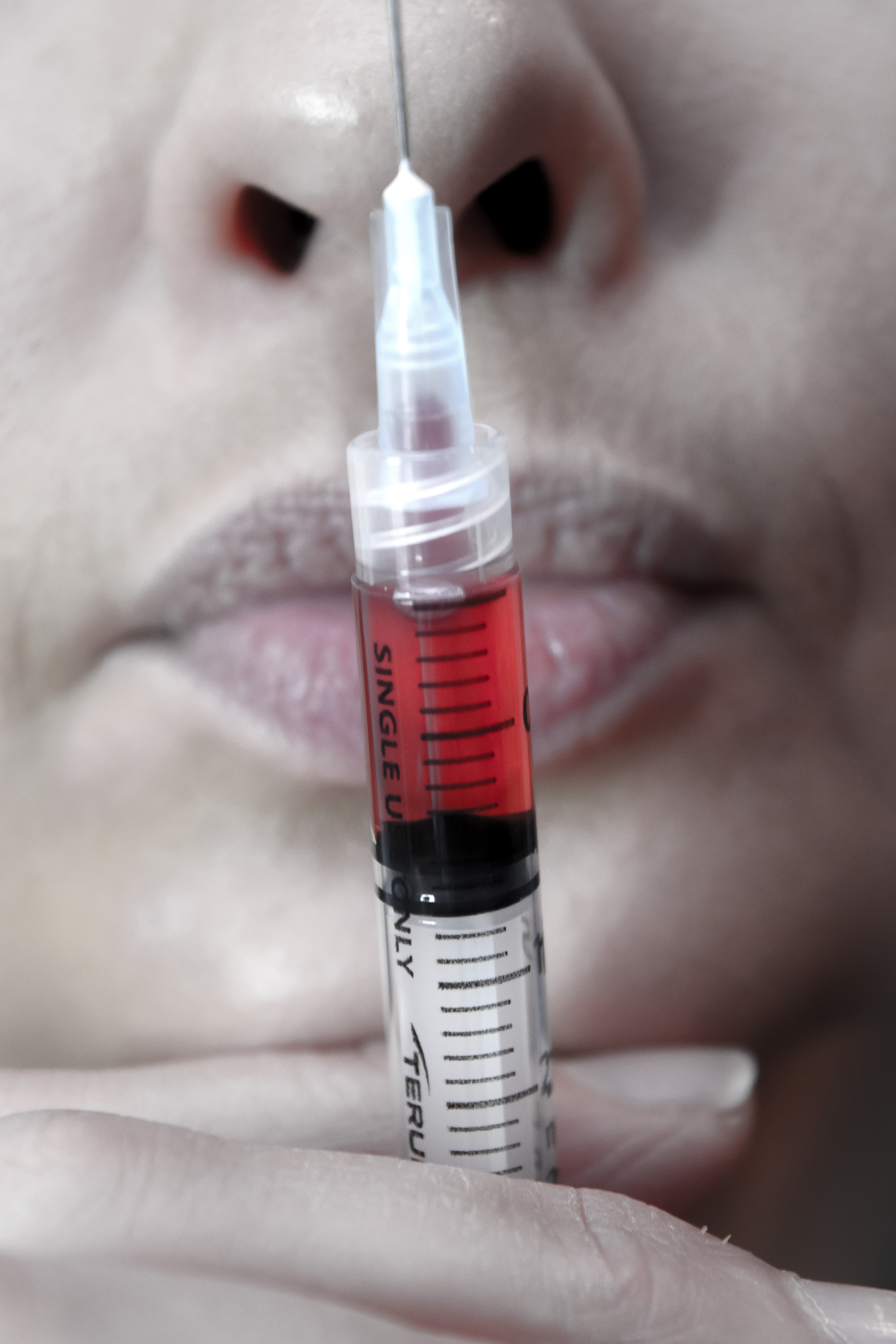 Skin booster injectable close-up